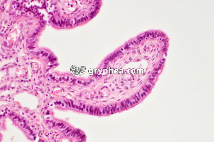 Trompe de Fallope x100 - gryphea.org